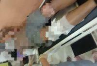 Diduga Belum Terdaftar di BPJS, Karyawan PT Inti Global Kembali Terkena Uap Panas